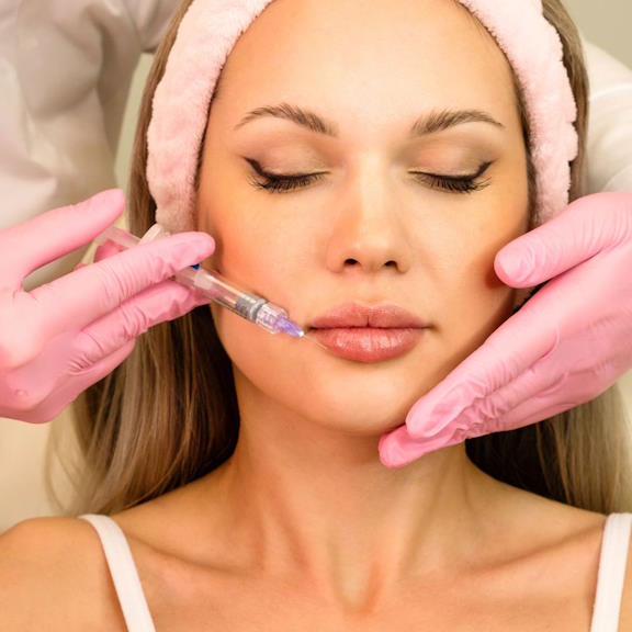 Dermal filler injection for lip enhancement and volume restoration