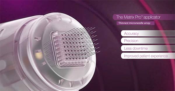 Matrix RF Microneedling device used at Fakour Clinic