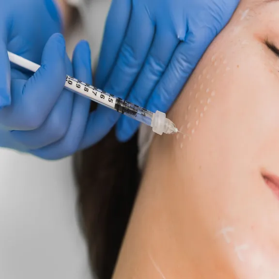 Facial mesotherapy with skin revitalization serum